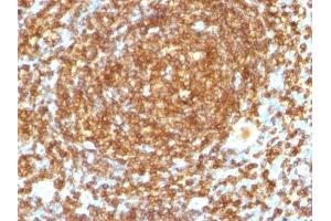 Image no. 2 for anti-CD45RB (CD45RB) antibody (ABIN6170649) (CD45RB anticorps)