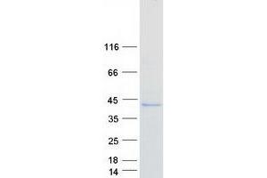 Validation with Western Blot