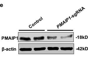 PMAIP1 is a CK-resistant gene. (NOXA anticorps  (AA 1-54))
