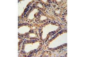 Immunohistochemistry (IHC) image for anti-Natriuretic Peptide A (NPPA) antibody (ABIN2917623)
