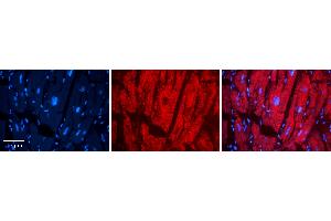 Rabbit Anti-LASP1 Antibody Catalog Number: ARP54798_P050 Formalin Fixed Paraffin Embedded Tissue: Human heart Tissue Observed Staining: Cytoplasmic Primary Antibody Concentration: N/A Other Working Concentrations: 1:600 Secondary Antibody: Donkey anti-Rabbit-Cy3 Secondary Antibody Concentration: 1:200 Magnification: 20X Exposure Time: 0.
