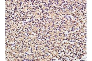 Paraformaldehyde-fixed, paraffin embedded fetal mouse brain tissue, Antigen retrieval by boiling in sodium citrate buffer(pH6) for 15min, Block endogenous peroxidase by 3% hydrogen peroxide for 30 minutes, Blocking buffer (normal goat serum) at 37°C for 20min, Antibody incubation with CD19 Polyclonal Antibody, Unconjugated  at 1:500 overnight at 4°C, followed by a conjugated secondary and DAB staining