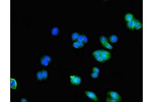 Immunofluorescent analysis of HepG2 cells using ABIN7143348 at dilution of 1:100 and Alexa Fluor 488-congugated AffiniPure Goat Anti-Rabbit IgG(H+L)