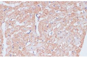 Immunohistochemistry of paraffin-embedded Rat heart using MZB1 Polyclonal Antibody at dilution of 1:100 (40x lens). (MZB1 anticorps)
