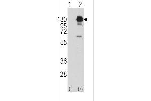 Western blot analysis of PDGFRA (arrow) using rabbit polyclonal PDGFRA Antibody  (R). (PDGFRA anticorps  (AA 740-769))