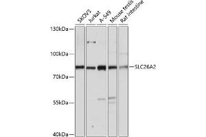 Western blot analysis of extracts of various cell lines, using SLC26 antibody (ABIN7270440) at 1:3000 dilution.