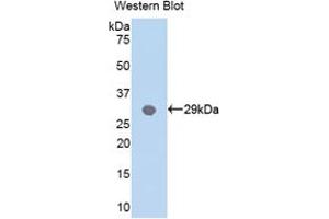 Western blot analysis of the recombinant protein. (MYD88 anticorps  (AA 32-265))