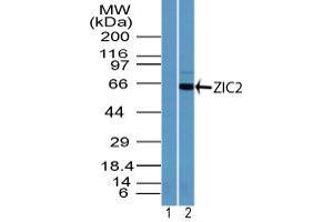 Image no. 1 for anti-ZIC2 (ZIC2) (AA 350-400) antibody (ABIN960412) (ZIC2 anticorps  (AA 350-400))