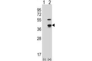 Western Blotting (WB) image for anti-Cyclin-Dependent Kinase 3 (CDK3) antibody (ABIN2997548)