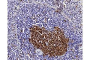 Immunohistochemistry analysis of paraffin-embedded rat spleen using Survivin Polyclonal Antibody at dilution of 1:300.