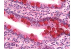 anti-Intelectin 1 (Galactofuranose Binding) (ITLN1) (AA 27-168) antibody