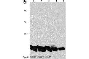 Western blot analysis of A549 and hela cell, mouse liver and human liver tissue, hepG2 cell, using PGK1 Polyclonal Antibody at dilution of 1:850 (PGK1 anticorps)