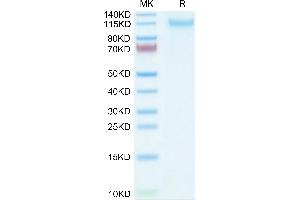 Mouse VLDLR on Tris-Bis PAGE under reduced condition.