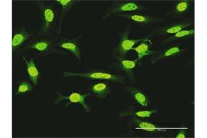 Immunofluorescence of purified MaxPab antibody to KIAA1967 on HeLa cell. (CCAR2 anticorps  (AA 1-923))