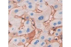 IHC-P analysis of Human Tissue, with DAB staining. (LRP5 anticorps  (AA 769-1016))