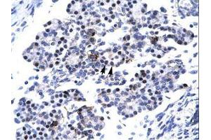 Image no. 3 for anti-Caudal Type Homeobox 4 (CDX4) (C-Term) antibody (ABIN6736267)