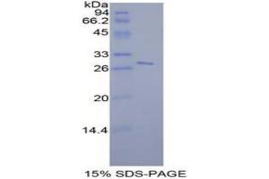 SDS-PAGE analysis of Mouse STAT6 Protein. (STAT6 Protéine)