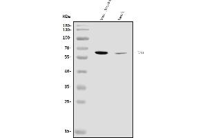 Western blot analysis of TBX4 using anti-TBX4 antibody (ABIN7602998).