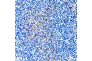 Immunohistochemistry of paraffin-embedded mouse spleen using PSMD10 antibody  at dilution of 1:100 (40x lens).