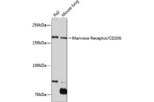 Western blot analysis of extracts of various cell lines, using Mannose Receptor/CD206 Rabbit mAb (ABIN7268388) at 1:1000 dilution. (Macrophage Mannose Receptor 1 anticorps)
