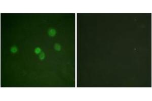 Immunofluorescence analysis of A549 cells, using SP1 (Ab-453) Antibody. (SP1 anticorps  (AA 421-470))