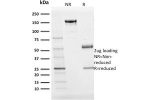 SDS-PAGE Analysis Purified BOB1 Monospecific Mouse Monoclonal Antibody (BOB1/2424).