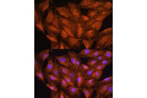 Immunofluorescence analysis of H9C2 cells using D Rabbit pAb (ABIN6127743, ABIN6139383, ABIN6139384 and ABIN6223348) at dilution of 1:100. (DAAM2 anticorps  (AA 1-86))