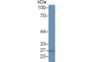 Western Blot; Sample: Porcine Liver lysate; Primary Ab: 2µg/ml Rabbit Anti-Human IL13Ra1 Antibody Second Ab: 0.