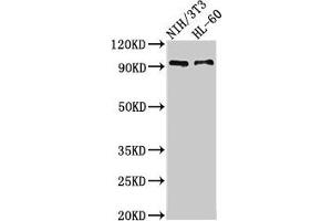 Western Blot Positive WB detected in: NIH/3T3 whole cell lysate, HL60 whole cell lysate All lanes: IL17RA antibody at 3. (IL17RA anticorps  (AA 552-743))