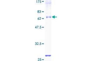 Image no. 1 for Ubiquitin Specific Peptidase 18 (USP18) (AA 1-372) protein (GST tag) (ABIN1324762)