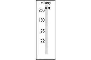 Western blot analysis of LRP5 Antibody (C-term) in mouse lung tissue lysates (35ug/lane). (LRP5 anticorps  (C-Term))