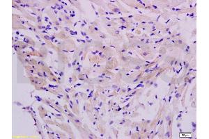 Formalin-fixed and paraffin embedded rat heart labeled with Anti-FLIP Polyclonal Antibody, Unconjugated (ABIN737946) at 1:200 followed by conjugation to the secondary antibody and DAB staining.
