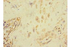 Immunohistochemistry of paraffin-embedded human placenta tissue using ABIN7152671 at dilution of 1:100 (FCRL6 anticorps  (AA 20-307))