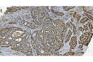 IHC analysis of Transketolase/TKT using anti-Transketolase/TKT antibody (ABIN7598958). (TKT anticorps  (AA 1-116))