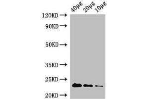 Western Blot Positive WB detected in: Rosseta bacteria lysate at 40 μg, 20 μg, 10 μg All lanes: rpiA antibody at 1 μg/mL Secondary Goat polyclonal to rabbit IgG at 1/50000 dilution Predicted band size: 23 kDa Observed band size: 23 kDa (Ribose 5-Phosphate Isomerase A (RPIA) (AA 1-219) anticorps (Biotin))