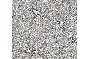 IHC analysis of Glycine decarboxylase/GLDC using anti-Glycine decarboxylase/GLDC antibody (ABIN7602073). (GLDC anticorps  (AA 574-1020))