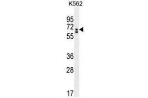 CLIP3 Antibody (C-term) western blot analysis in K562 cell line lysates (35µg/lane). (CLIP3 anticorps  (C-Term))