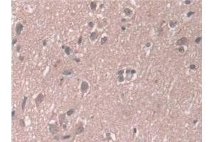 Detection of AASS in Human Cerebrum Tissue using Polyclonal Antibody to Aminoadipate Semialdehyde Synthase (AASS)