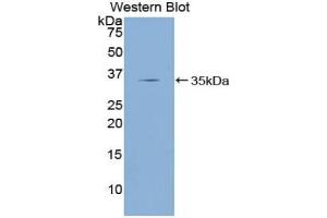 Western blot analysis of the recombinant protein. (KLF4 anticorps  (AA 187-474))