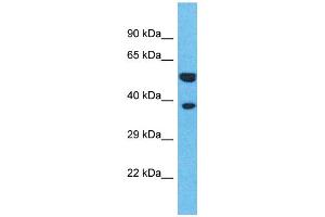 Western Blotting (WB) image for anti-Olfactory Receptor, Family 4, Subfamily L, Member 1 (OR4L1) (C-Term) antibody (ABIN2791742) (OR4L1 anticorps  (C-Term))