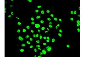 Immunofluorescence analysis of U2OS cells using EFTUD2 antibody.