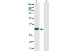 Western Blot analysis of IGFBP1 expression in transfected 293T cell line by IGFBP1 monoclonal antibody (M01), clone 2F9. (IGFBPI anticorps  (AA 160-259))