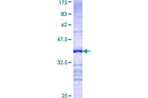 Image no. 1 for Protein Phosphatase 1, Regulatory (Inhibitor) Subunit 15A (PPP1R15A) (AA 1-100) protein (GST tag) (ABIN1315962)