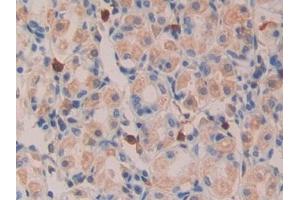 Detection of TGFa in Human Kidney Tissue using Polyclonal Antibody to Transforming Growth Factor Alpha (TGFa) (TGFA anticorps  (AA 24-98))
