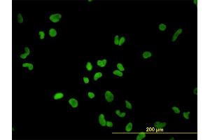 Immunofluorescence of monoclonal antibody to PTBP1 on HeLa cell.