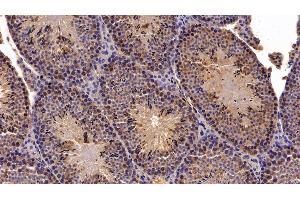 Detection of MGEA5 in Mouse Testis Tissue using Polyclonal Antibody to Meningioma Expressed Antigen 5 (MGEA5)