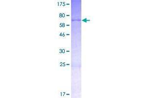 Image no. 1 for SAC3 Domain Containing 1 (SAC3D1) (AA 1-404) protein (GST tag) (ABIN1319106)