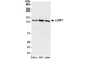 Western Blotting (WB) image for anti-Leucine Zipper Protein 1 (LUZP1) (AA 1-50) antibody (ABIN7449764)