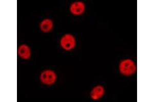 ABIN6274025 staining MCF7 by IF/ICC.