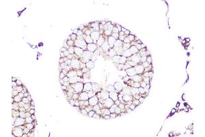 Immunohistochemistry of paraffin-embedded rat testis using RHOA/RHOB/RHOC Rabbit mAb (ABIN1678636, ABIN3019244, ABIN3019245 and ABIN7101735) at dilution of 1:100 (40x lens). (RhoA,B,C anticorps)